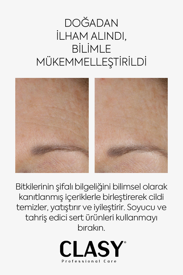 Ölü Deriye Karşı Kil Maskesi - 100 ml