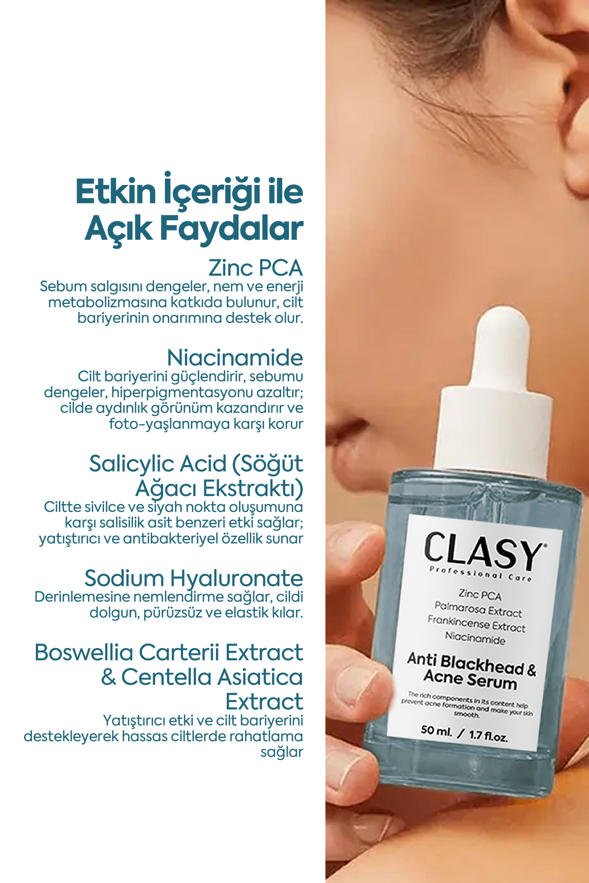 Siyah Nokta ve Akne Düşmanı - Anti Blackhead & Acne Serum 50 ml