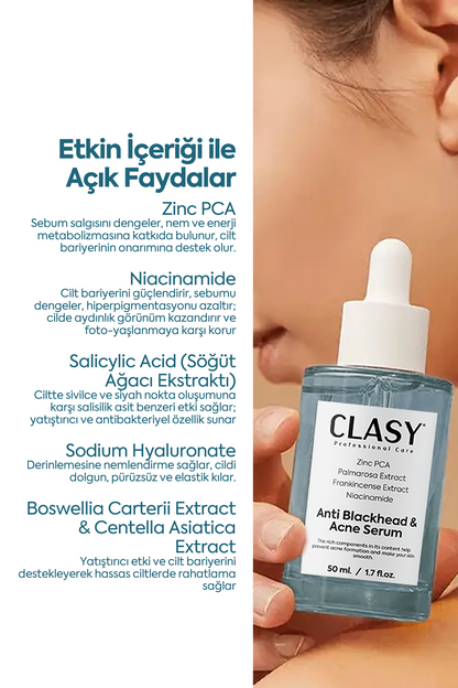 Siyah Nokta ve Akne Düşmanı - Anti Blackhead & Acne Serum 50 ml