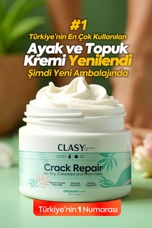 Topuk Çatlakları ve Ayaklar için Mükemmel Bakım Kremi - 100 ml