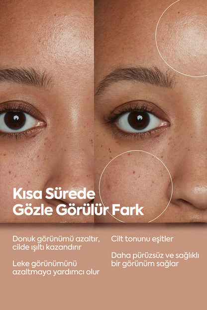 Aydınlatıcı Ve Leke Görünümü Azaltıcı - Brightening Serum 50 ml