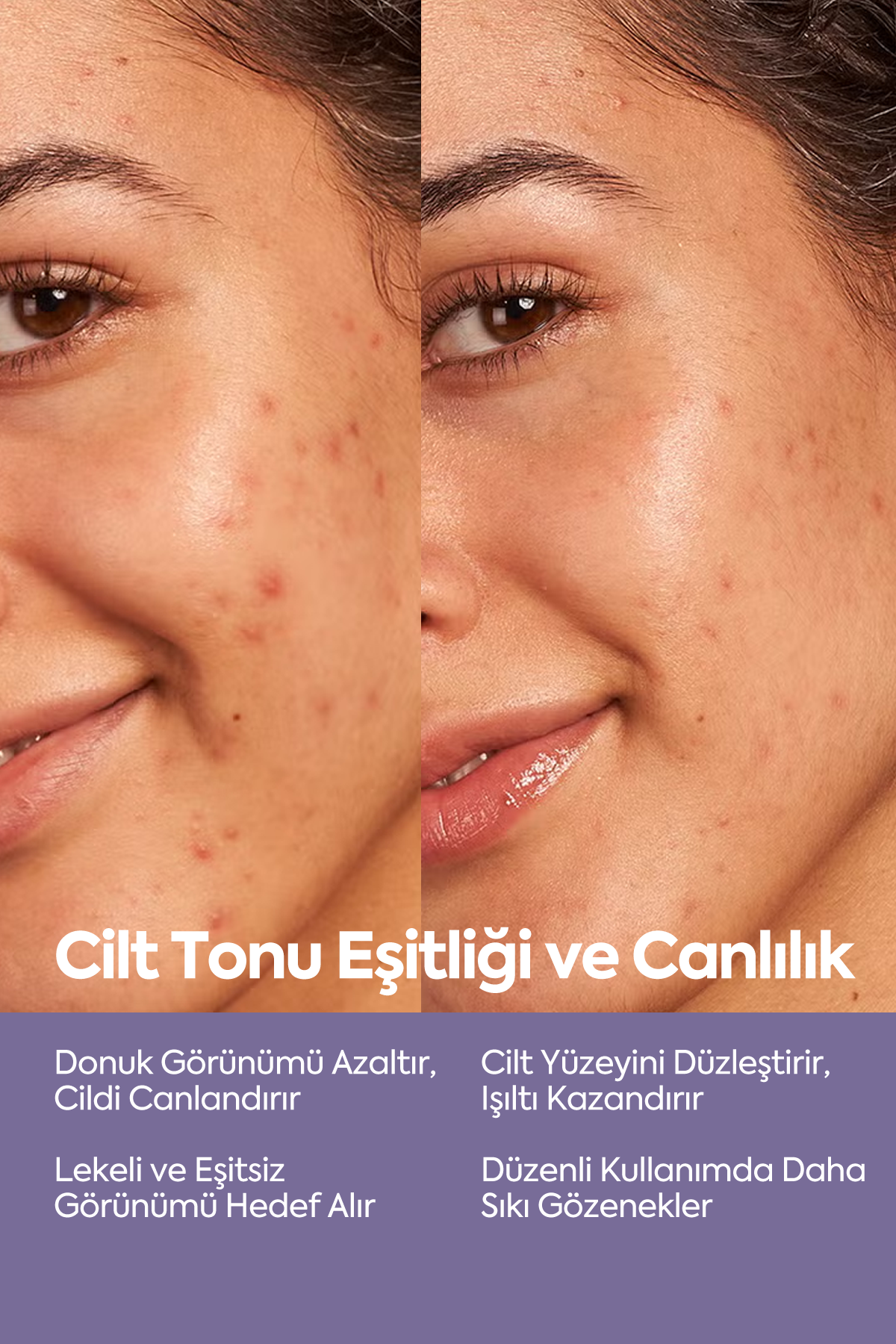 Cilt Tonu Eşitleyici Peeling - Exfoliating AHA-BHA Serum 50 ml