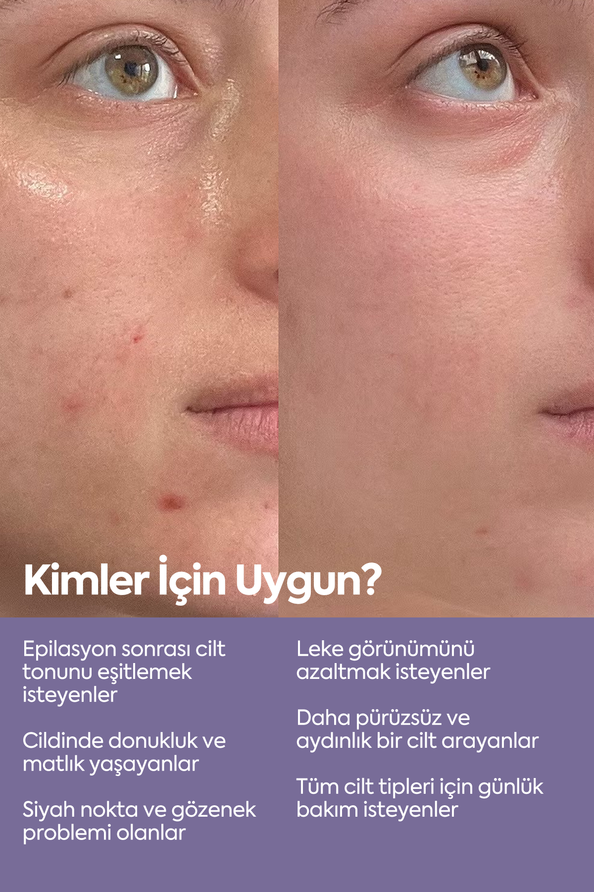 Cilt Tonu Eşitleyici Peeling - Exfoliating AHA-BHA Serum 50 ml