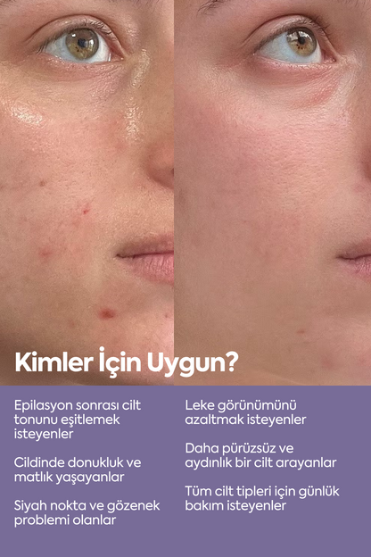 Cilt Tonu Eşitleyici Peeling - Exfoliating AHA-BHA Serum 50 ml
