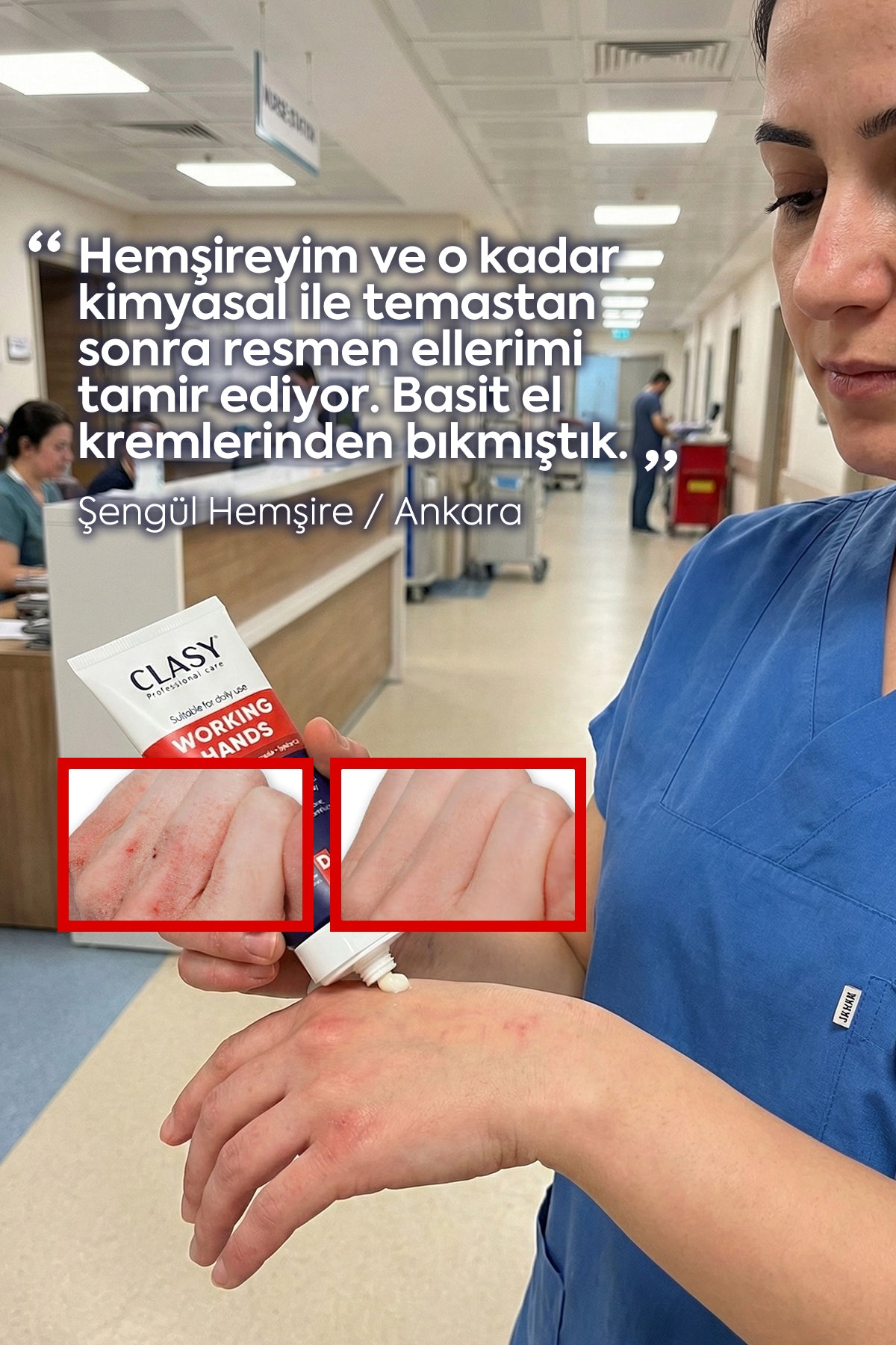 Working Hands - En Güçlü El Kremi 100 ml