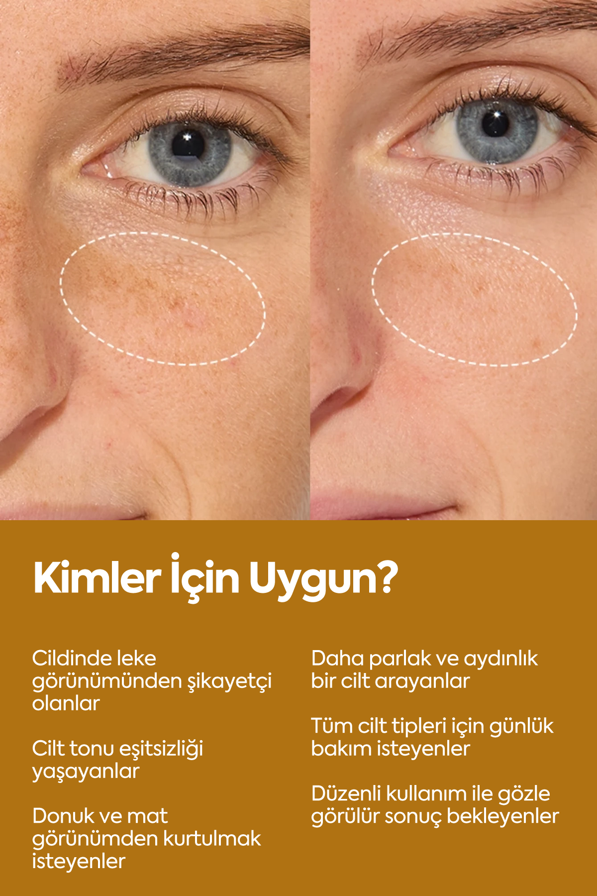 Aydınlatıcı Ve Leke Görünümü Azaltıcı - Brightening Serum 50 ml