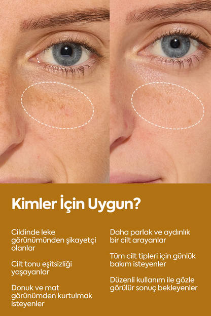 Aydınlatıcı Ve Leke Görünümü Azaltıcı - Brightening Serum 50 ml