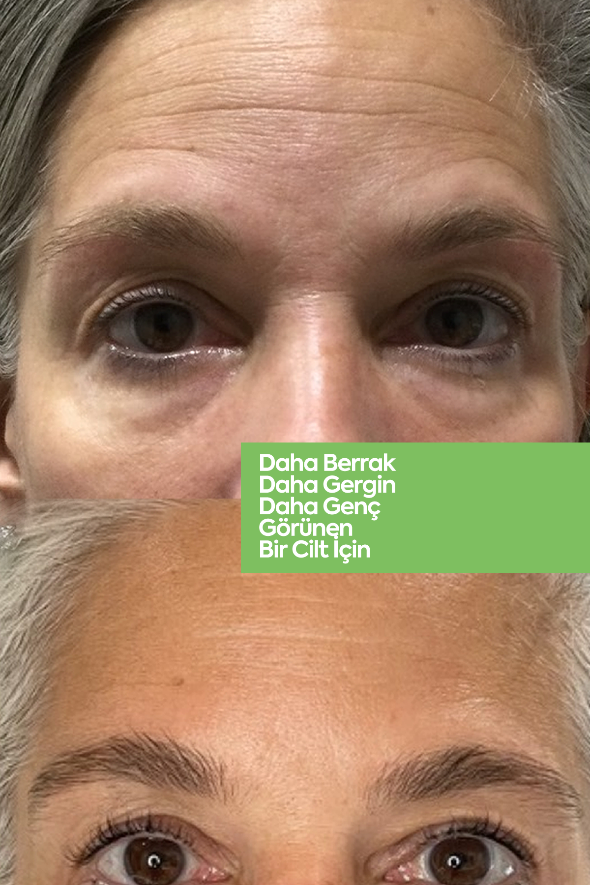 Aloe Vera Gel Mask - Gençleştirici Jel Maske - 20 Şaset