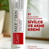 Akne ve Sivilceler için Mükemmel Etki - FACEUPSKIN® Acne Cream 40 ml