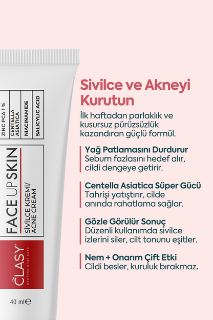 Akne ve Sivilceler için Mükemmel Etki - FACEUPSKIN® Acne Cream 40 ml