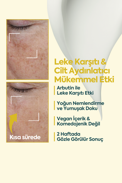 Aydınlatıcı Leke Kremi - FACEUPSKIN® Spot Cream 40 ml