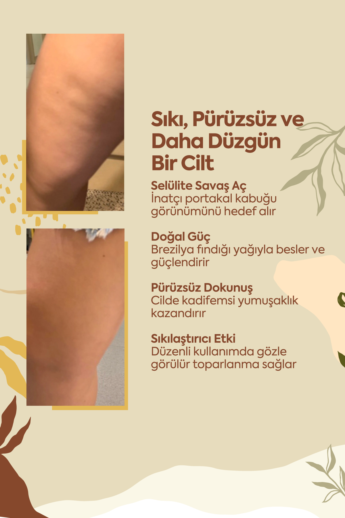 Selülite Karşı Mükemmel Koruma - 100 ml