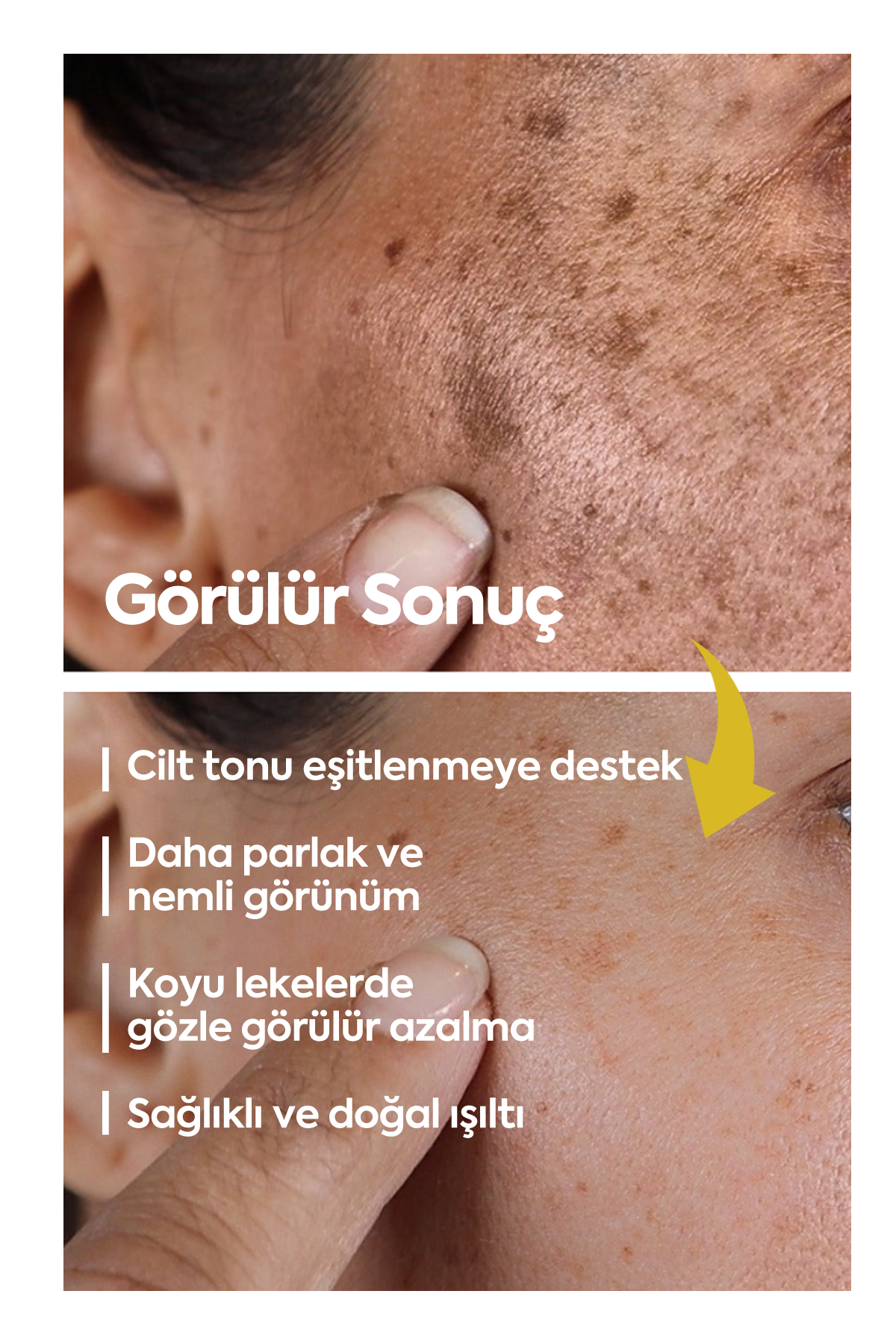 Aydınlatıcı Leke Kremi - FACEUPSKIN® Spot Cream 40 ml