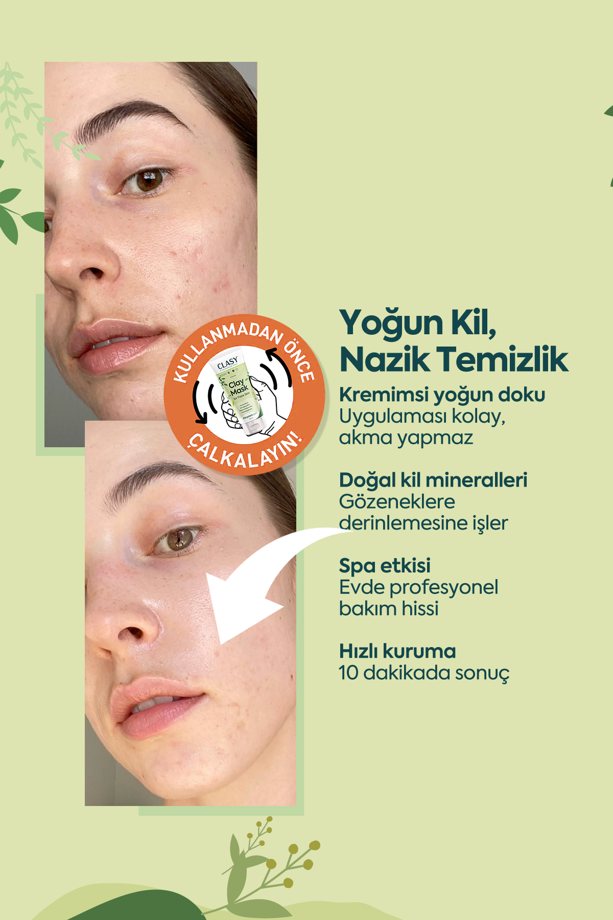 Ölü Deriye Karşı Kil Maskesi - 100 ml