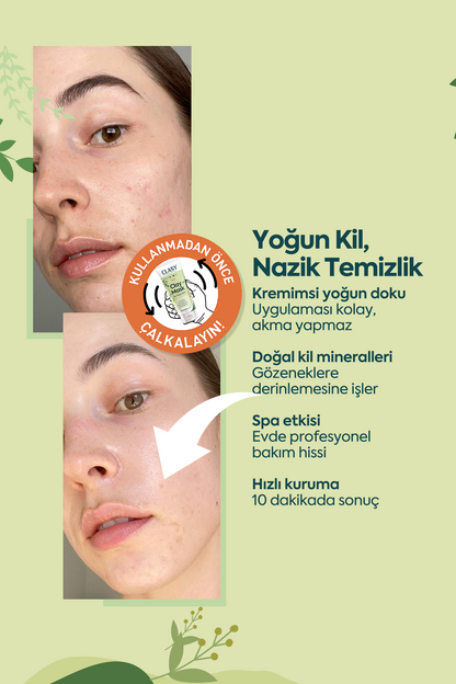 Ölü Deriye Karşı Kil Maskesi - 100 ml
