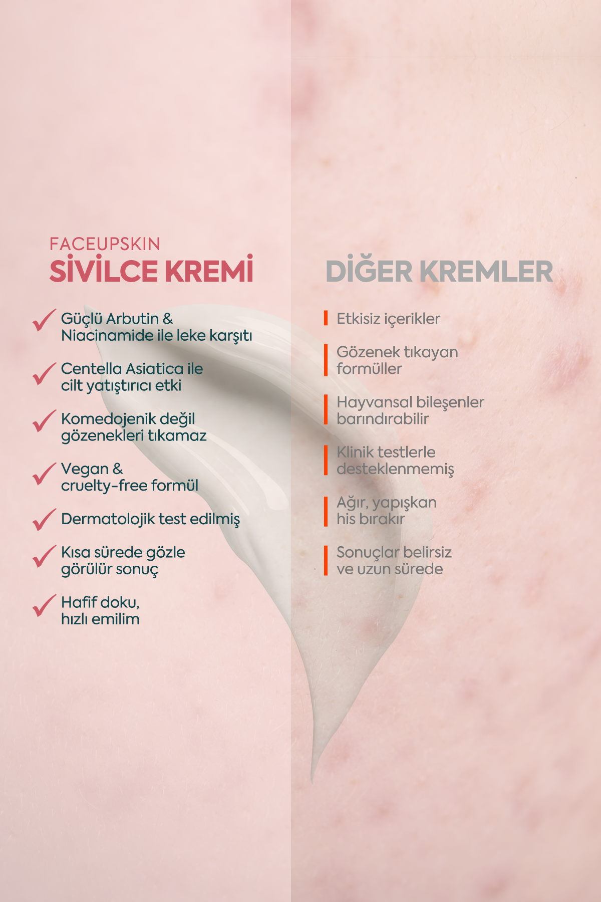 Akne ve Sivilceler için Mükemmel Etki - FACEUPSKIN® Acne Cream 40 ml