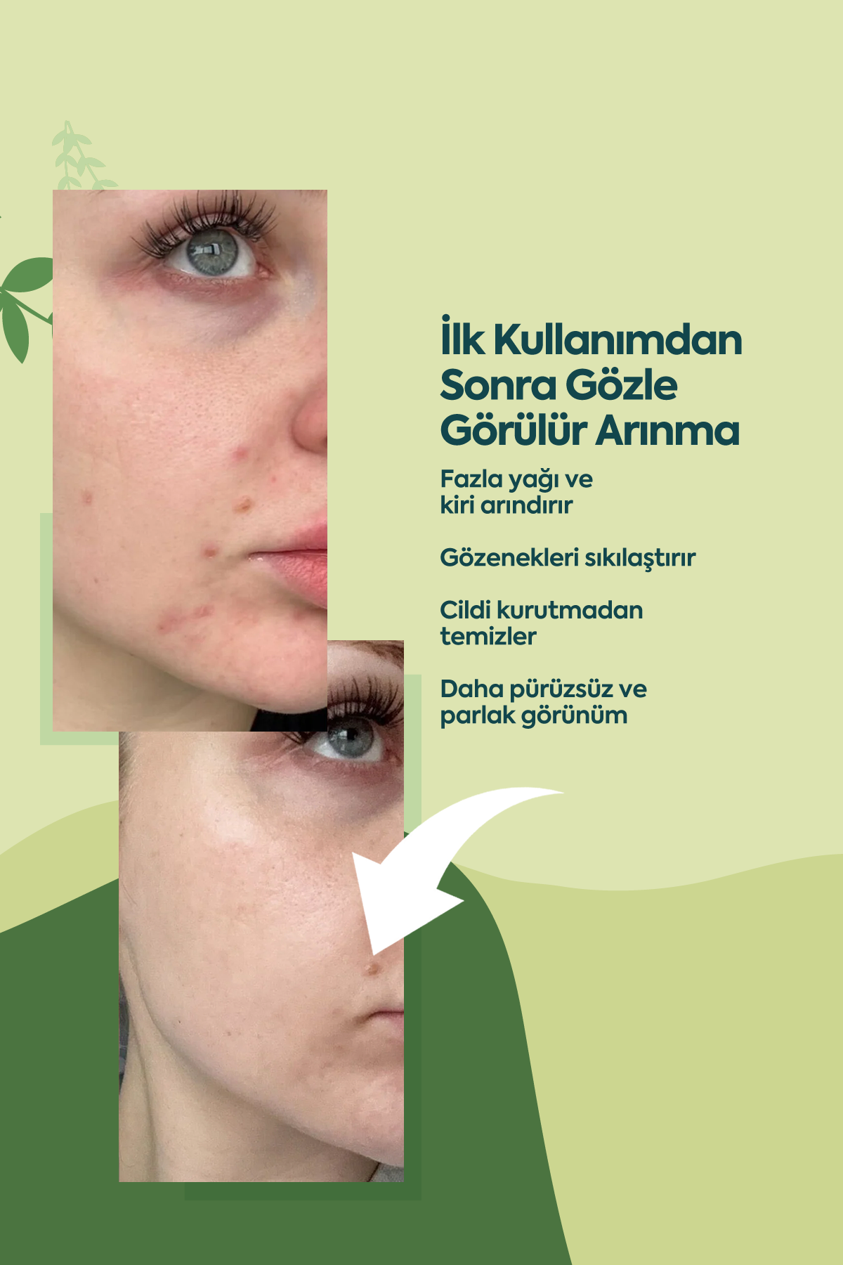 Ölü Deriye Karşı Kil Maskesi - 100 ml