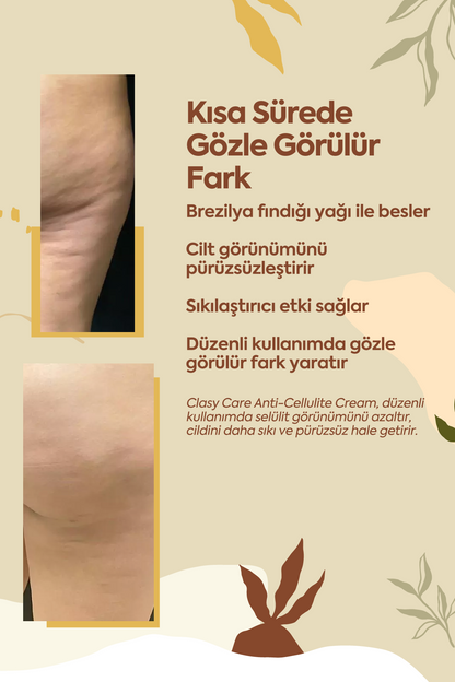 Selülite Karşı Mükemmel Koruma - 100 ml