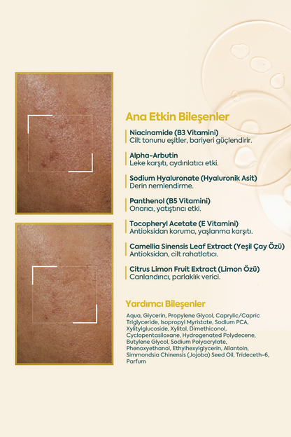 Aydınlatıcı Leke Kremi - FACEUPSKIN® Spot Cream 40 ml