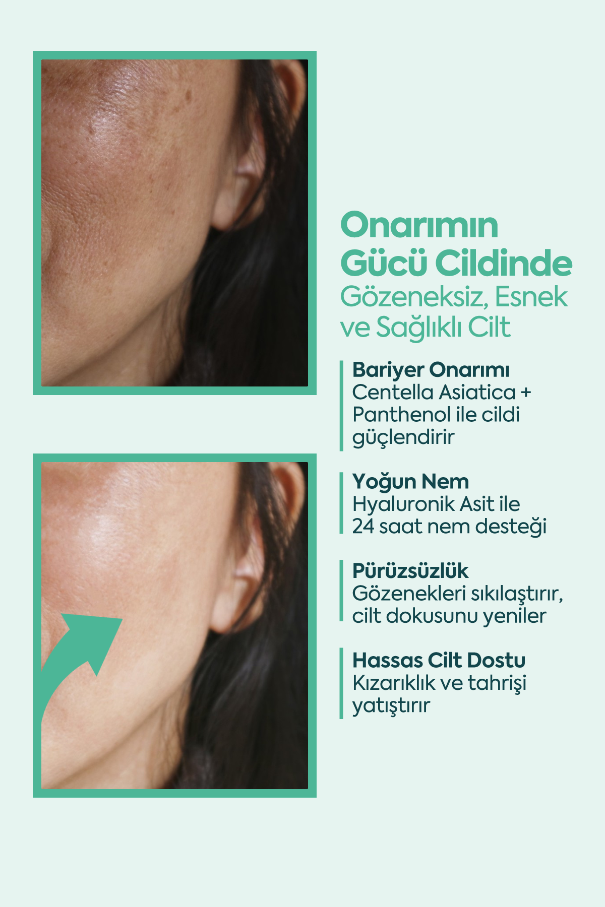 Mükemmel Cilt Onarıcı - FACEUPSKIN® Restorative Cream 40 ml