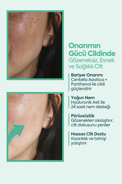 Mükemmel Cilt Onarıcı - FACEUPSKIN® Restorative Cream 40 ml